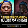 The story of The Ethiopian Boy Bullied For His Beautiful Blue Eyes. Abush
