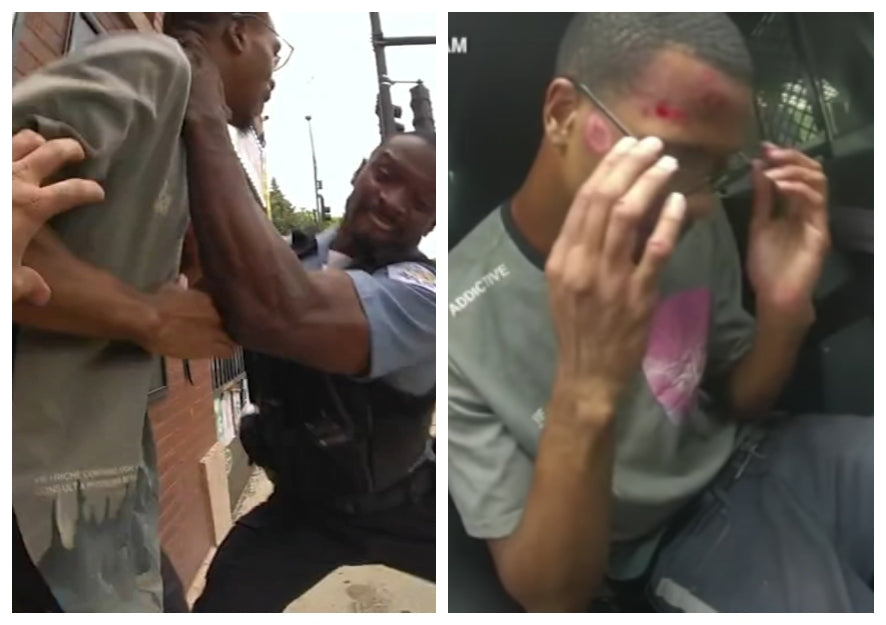Feature News: Black Man Violently Arrested By Chicago Police For Having ‘A Shocked Look On His Face’ Files Lawsuit