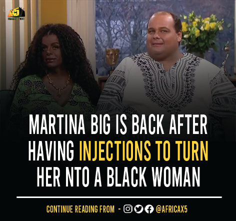 Martina Big Is Back After Having Injections to Turn Her Into a Black Woman